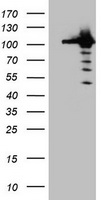 Cullin 4B / CUL4B Antibody - HEK293T cells were transfected with the pCMV6-ENTRY control (Left lane) or pCMV6-ENTRY CUL4B (Right lane) cDNA for 48 hrs and lysed. Equivalent amounts of cell lysates (5 ug per lane) were separated by SDS-PAGE and immunoblotted with anti-CUL4B.