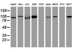 Cullin 4B / CUL4B Antibody - Western blot of extracts (35 ug) from 9 different cell lines by using anti-CUL4B monoclonal antibody (HepG2: human; HeLa: human; SVT2: mouse; A549: human; COS7: monkey; Jurkat: human; MDCK: canine; PC12: rat; MCF7: human).