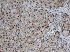 Cullin 4B / CUL4B Antibody - IHC of paraffin-embedded Human pancreas tissue using anti-CUL4B mouse monoclonal antibody.