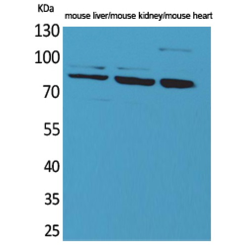 Cullin 4B / CUL4B Antibody - Western blot of CUL-4B antibody