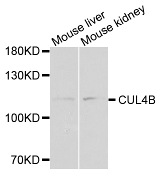 Cullin 4B / CUL4B Antibody - Western blot analysis of extracts of mouse tissues.