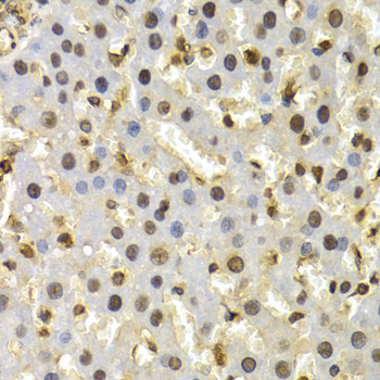 Cullin 4B / CUL4B Antibody - Immunohistochemistry of paraffin-embedded rat liver tissue.