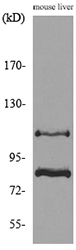Cullin 4B / CUL4B Antibody - Western blot analysis of lysate from mouse liver cells, using CUL4B Antibody.