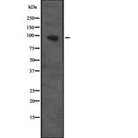 Cullin 4B / CUL4B Antibody - Western blot analysis of CUL4B expression in Transfected 293T cells lysate. The lane on the left is treated with the antigen-specific peptide.