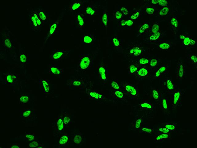 Cullin 4B / CUL4B Antibody - Immunofluorescence staining of CUL4B in U251MG cells. Cells were fixed with 4% PFA, permeabilzed with 0.1% Triton X-100 in PBS, blocked with 10% serum, and incubated with rabbit anti-Human CUL4B polyclonal antibody (dilution ratio 1:200) at 4°C overnight. Then cells were stained with the Alexa Fluor 488-conjugated Goat Anti-rabbit IgG secondary antibody (green). Positive staining was localized to Nucleus.