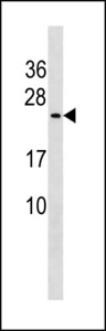 CUTA Antibody - CUTA Antibody western blot of 293 cell line lysates (35 ug/lane). The CUTA antibody detected the CUTA protein (arrow).