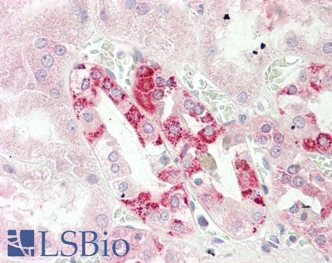 CUTA Antibody - Anti-CUTA antibody IHC staining of human kidney. Immunohistochemistry of formalin-fixed, paraffin-embedded tissue after heat-induced antigen retrieval. Antibody concentration 10 ug/ml.  This image was taken for the unconjugated form of this product. Other forms have not been tested.