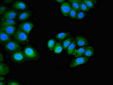 CUTA Antibody - Immunofluorescent analysis of A549 cells diluted at 1:100 and Alexa Fluor 488-congugated AffiniPure Goat Anti-Rabbit IgG(H+L)