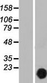 CUTA Protein - Western validation with an anti-DDK antibody * L: Control HEK293 lysate R: Over-expression lysate