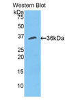 CUTC Antibody - Western blot of recombinant CUTC.  This image was taken for the unconjugated form of this product. Other forms have not been tested.