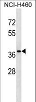CUTC Antibody - CUTC Antibody western blot of NCI-H460 cell line lysates (35 ug/lane). The CUTC antibody detected the CUTC protein (arrow).