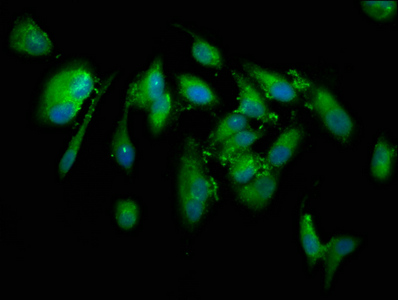 CUTC Antibody - Immunofluorescence staining of Hela cells at a dilution of 1:133, counter-stained with DAPI. The cells were fixed in 4% formaldehyde, permeabilized using 0.2% Triton X-100 and blocked in 10% normal Goat Serum. The cells were then incubated with the antibody overnight at 4 °C.The secondary antibody was Alexa Fluor 488-congugated AffiniPure Goat Anti-Rabbit IgG (H+L) .