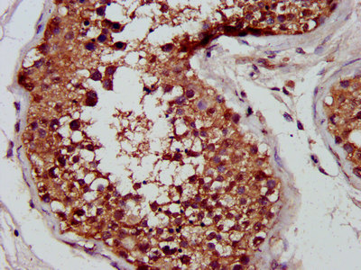 CUTC Antibody - Immunohistochemistry image at a dilution of 1:400 and staining in paraffin-embedded human testis tissue performed on a Leica BondTM system. After dewaxing and hydration, antigen retrieval was mediated by high pressure in a citrate buffer (pH 6.0) . Section was blocked with 10% normal goat serum 30min at RT. Then primary antibody (1% BSA) was incubated at 4 °C overnight. The primary is detected by a biotinylated secondary antibody and visualized using an HRP conjugated SP system.