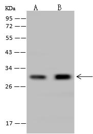 CUTC Antibody - Anti-CUTC rabbit polyclonal antibody at 1:500 dilution. Lane A: Jurkat Whole Cell Lysate. Lane B: HeLa Whole Cell Lysate. Lysates/proteins at 30 ug per lane. Secondary: Goat Anti-Rabbit IgG (H+L)/HRP at 1/10000 dilution. Developed using the ECL technique. Performed under reducing conditions. Predicted band size: 29 kDa. Observed band size: 29 kDa.