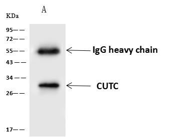 CUTC Antibody - CUTC was immunoprecipitated using: Lane A: 0.5 mg HeLa Whole Cell Lysate. 4 uL anti-CUTC rabbit polyclonal antibody and 60 ug of Immunomagnetic beads Protein A/G. Primary antibody: Anti-CUTC rabbit polyclonal antibody, at 1:100 dilution. Secondary antibody: Goat Anti-Rabbit IgG (H+L)/HRP at 1/10000 dilution. Developed using the ECL technique. Performed under reducing conditions. Predicted band size: 29 kDa. Observed band size: 29 kDa.