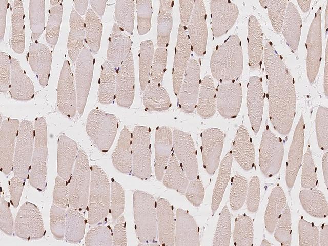 CUTC Antibody - Immunochemical staining of human CUTC in human skeletal muscle with rabbit polyclonal antibody at 1:100 dilution, formalin-fixed paraffin embedded sections.