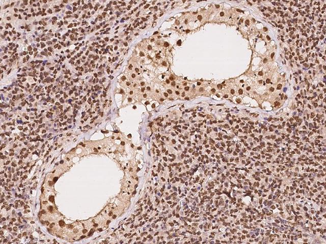 CUTC Antibody - Immunochemical staining of human CUTC in human testis with rabbit polyclonal antibody at 1:100 dilution, formalin-fixed paraffin embedded sections.