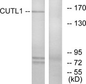 CUX1 / CASP Antibody - Western blot analysis of lysates from K562 cells, using CUTL1 Antibody. The lane on the right is blocked with the synthesized peptide.
