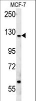 CUX1 / CASP Antibody - CUX1 Antibody western blot of MCF-7 cell line lysates (35 ug/lane). The CUX1 antibody detected the CUX1 protein (arrow).