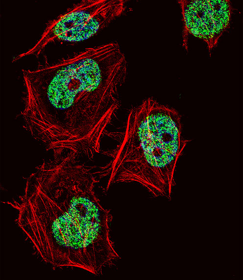 CUX1 / CASP Antibody - Fluorescent confocal image of HeLa cell stained with CUX1 Antibody. HeLa cells were fixed with 4% PFA (20 min), permeabilized with Triton X-100 (0.1%, 10 min), then incubated with CUX1 primary antibody (1:25, 1 h at 37°C). For secondary antibody, Alexa Fluor 488 conjugated donkey anti-rabbit antibody (green) was used (1:400, 50 min at 37°C). Cytoplasmic actin was counterstained with Alexa Fluor 555 (red) conjugated Phalloidin (7units/ml, 1 h at 37°C). Nuclei were counterstained with DAPI (blue) (10 ug/ml, 10 min). CUX1 immunoreactivity is localized to Nucleus significantly.