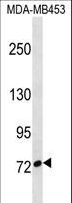 CUX1 / CASP Antibody - CUX1 Antibody western blot of MDA-MB453 cell line lysates (35 ug/lane). The CUX1 antibody detected the CUX1 protein (arrow).