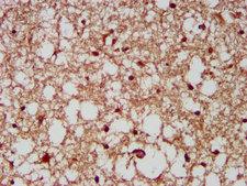 CUX1 / CASP Antibody - Immunohistochemistry image at a dilution of 1:200 and staining in paraffin-embedded human brain tissue performed on a Leica BondTM system. After dewaxing and hydration, antigen retrieval was mediated by high pressure in a citrate buffer (pH 6.0) . Section was blocked with 10% normal goat serum 30min at RT. Then primary antibody (1% BSA) was incubated at 4 °C overnight. The primary is detected by a biotinylated secondary antibody and visualized using an HRP conjugated SP system.