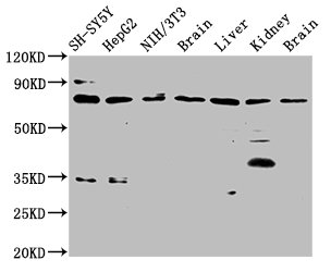 CUX1 / CASP Antibody - Positive Western Blot detected in SH-SY5Y whole cell lysate, HepG2 whole cell lysate, NIH/3T3 whole cell lysate, Rat brain tissue, Rat liver tissue, Rat kidney tissue, Mouse brain tissue. All lanes: CUX1 antibody at 3.7 µg/ml Secondary Goat polyclonal to rabbit IgG at 1/50000 dilution. Predicted band size: 78, 73 KDa. Observed band size: 78 KDa