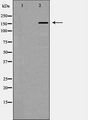 CUX1 / CASP Antibody - Western blot analysis of CUTL1 expression in K562 cells. The lane on the left is treated with the antigen-specific peptide.