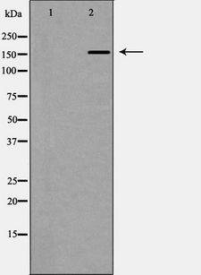 CUX1 / CASP Antibody - Western blot analysis of CUTL1 expression in K562 cells. The lane on the left is treated with the antigen-specific peptide.