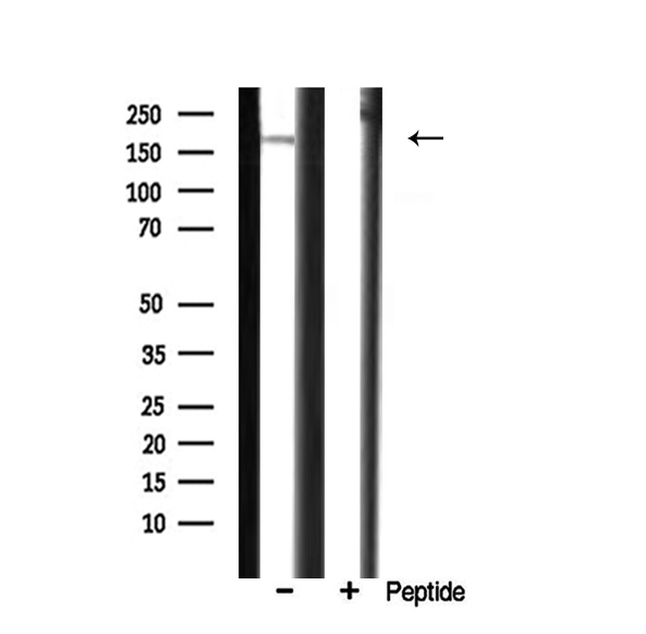 CUX1 / CASP Antibody - Western blot analysis of CUTL1 expression in rat heart.