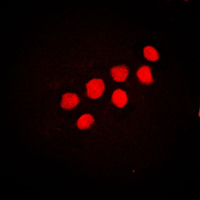 CUX1 / CASP Antibody - Immunofluorescent analysis of CUX1 staining in NIH3T3 cells. Formalin-fixed cells were permeabilized with 0.1% Triton X-100 in TBS for 5-10 minutes and blocked with 3% BSA-PBS for 30 minutes at room temperature. Cells were probed with the primary antibody in 3% BSA-PBS and incubated overnight at 4 C in a humidified chamber. Cells were washed with PBST and incubated with a DyLight 594-conjugated secondary antibody (red) in PBS at room temperature in the dark. DAPI was used to stain the cell nuclei (blue).