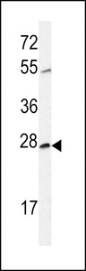 CWC15 Antibody - Western blot of CWC15 Antibody in CHO cell line lysates (35 ug/lane). CWC15 (arrow) was detected using the purified antibody.