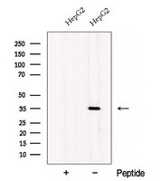 CWC15 Antibody - Western blot analysis of extracts of HepG2 cells using CWC15 antibody. The lane on the left was treated with blocking peptide.