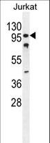 CWC22 Antibody - CWC22 Antibody western blot of Jurkat cell line lysates (35 ug/lane). The CWC22 antibody detected the CWC22 protein (arrow).