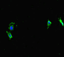 CWC22 Antibody - Immunofluorescent analysis of HeLa cells diluted at 1:100 and Alexa Fluor 488-congugated AffiniPure Goat Anti-Rabbit IgG(H+L)