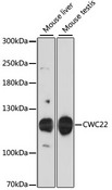 CWC22 Antibody - Western blot analysis of extracts of various cell lines, using CWC22 antibody at 1:3000 dilution. The secondary antibody used was an HRP Goat Anti-Rabbit IgG (H+L) at 1:10000 dilution. Lysates were loaded 25ug per lane and 3% nonfat dry milk in TBST was used for blocking. An ECL Kit was used for detection and the exposure time was 30s.