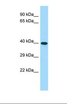 CWC25 Antibody - Western blot of Human Fetal Brain. CWC25 antibody dilution 1.0 ug/ml.  This image was taken for the unconjugated form of this product. Other forms have not been tested.
