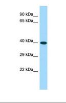 CWC25 Antibody - Western blot of Human Fetal Brain. CWC25 antibody dilution 1.0 ug/ml.  This image was taken for the unconjugated form of this product. Other forms have not been tested.