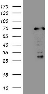 CWC27 Antibody - HEK293T cells were transfected with the pCMV6-ENTRY control. (Left lane) or pCMV6-ENTRY CWC27. (Right lane) cDNA for 48 hrs and lysed. Equivalent amounts of cell lysates. (5 ug per lane) were separated by SDS-PAGE and immunoblotted with anti-CWC27.