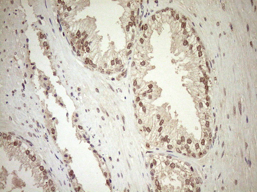 CWC27 Antibody - Immunohistochemical staining of paraffin-embedded Human prostate tissue within the normal limits using anti-CWC27 mouse monoclonal antibody. (Heat-induced epitope retrieval by 1mM EDTA in 10mM Tris buffer. (pH8.5) at 120°C for 3 min. (1:150)