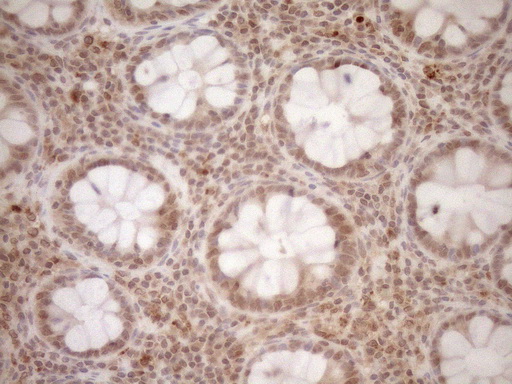 CWC27 Antibody - Immunohistochemical staining of paraffin-embedded Human colon tissue within the normal limits using anti-CWC27 mouse monoclonal antibody. (Heat-induced epitope retrieval by 1mM EDTA in 10mM Tris buffer. (pH8.5) at 120°C for 3 min. (1:150)