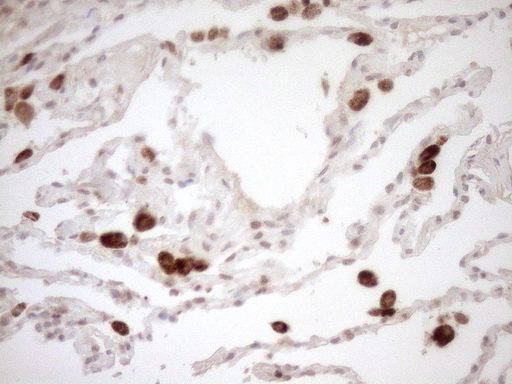 CWC27 Antibody - Immunohistochemical staining of paraffin-embedded Human lung tissue within the normal limits using anti-CWC27 mouse monoclonal antibody. (Heat-induced epitope retrieval by 1mM EDTA in 10mM Tris buffer. (pH8.5) at 120°C for 3 min. (1:150)