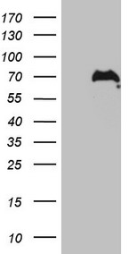 CWC27 Antibody - HEK293T cells were transfected with the pCMV6-ENTRY control. (Left lane) or pCMV6-ENTRY CWC27. (Right lane) cDNA for 48 hrs and lysed