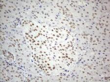 CWC27 Antibody - Immunohistochemical staining of paraffin-embedded Human pancreas tissue within the normal limits using anti-CWC27 mouse monoclonal antibody. (Heat-induced epitope retrieval by 1mM EDTA in 10mM Tris buffer. (pH8.5) at 120°C for 3 min. (1:150)