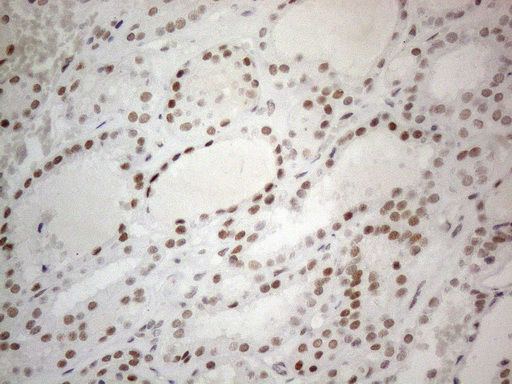 CWC27 Antibody - Immunohistochemical staining of paraffin-embedded Human thyroid tissue within the normal limits using anti-CWC27 mouse monoclonal antibody. (Heat-induced epitope retrieval by 1mM EDTA in 10mM Tris buffer. (pH8.5) at 120°C for 3 min. (1:150)