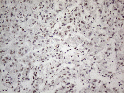 CWC27 Antibody - Immunohistochemical staining of paraffin-embedded Human liver tissue within the normal limits using anti-CWC27 mouse monoclonal antibody. (Heat-induced epitope retrieval by 1mM EDTA in 10mM Tris buffer. (pH8.5) at 120°C for 3 min. (1:150)