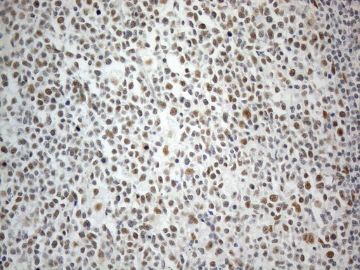 CWC27 Antibody - Immunohistochemical staining of paraffin-embedded Human tonsil within the normal limits using anti-CWC27 mouse monoclonal antibody. (Heat-induced epitope retrieval by 1mM EDTA in 10mM Tris buffer. (pH8.5) at 120°C for 3 min. (1:150)