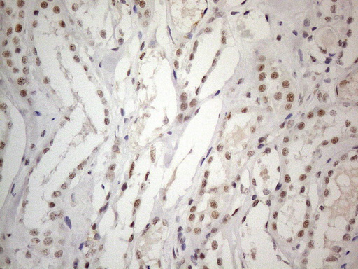 CWC27 Antibody - Immunohistochemical staining of paraffin-embedded Human Kidney tissue within the normal limits using anti-CWC27 mouse monoclonal antibody. (Heat-induced epitope retrieval by 1mM EDTA in 10mM Tris buffer. (pH8.5) at 120°C for 3 min. (1:150)