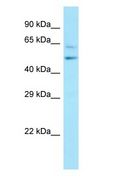 CWC27 Antibody - CWC27 antibody Western Blot of Jurkat.  This image was taken for the unconjugated form of this product. Other forms have not been tested.