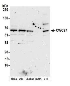 CWC27 Antibody - Detection of human and mouse CWC27 by western blot. Samples: Whole cell lysate (15 µg) from HeLa, HEK293T, Jurkat, mouse TCMK-1, and mouse NIH 3T3 cells prepared using NETN lysis buffer. Antibody: Affinity purified rabbit anti-CWC27 antibody used for WB at 1:1000. Detection: Chemiluminescence with an exposure time of 3 minutes.